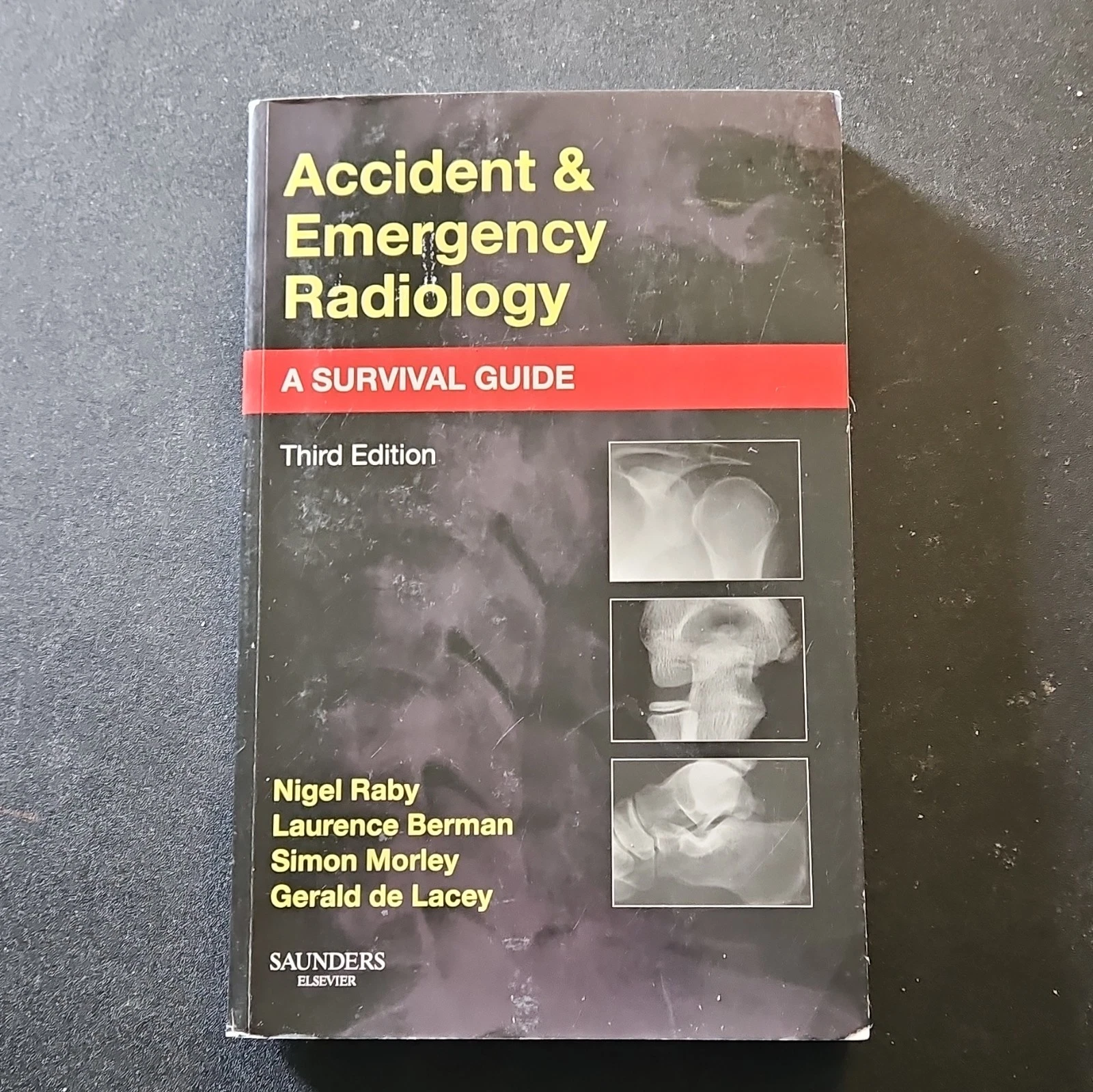 Accident and Emergency Radiology